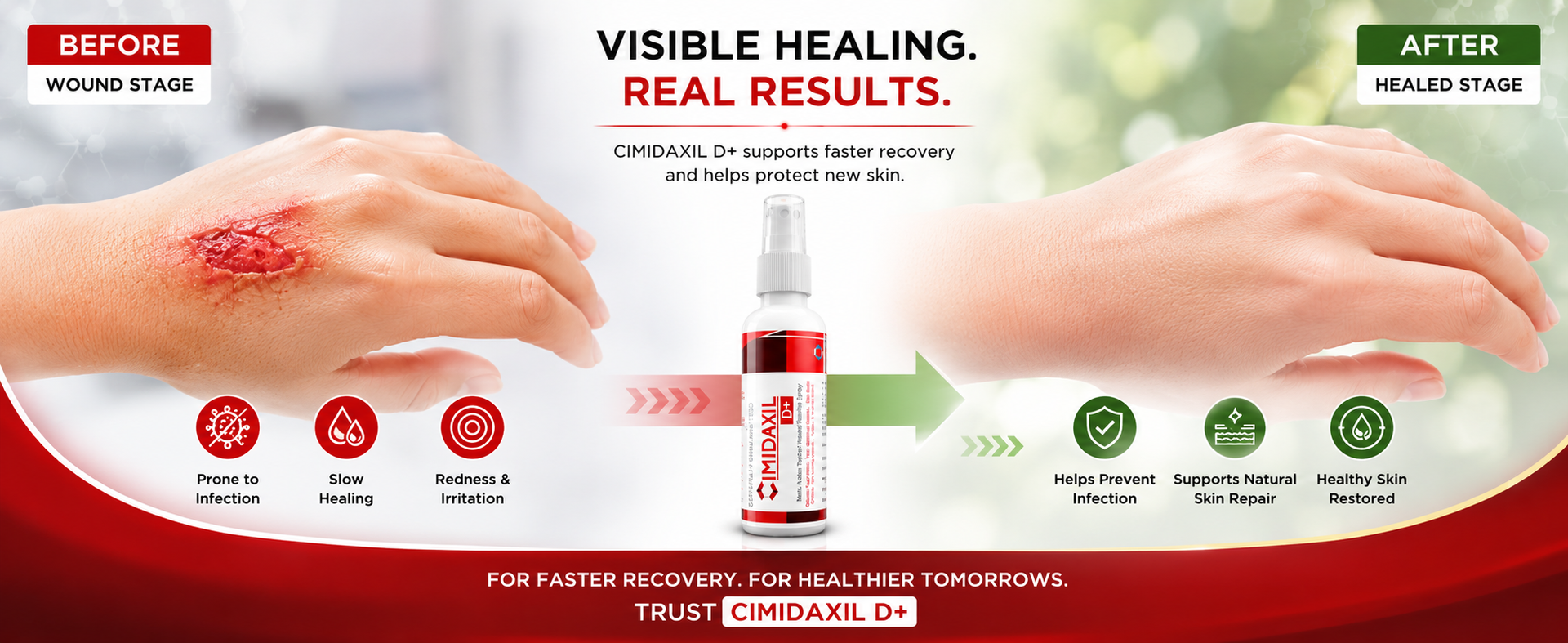 D+ Wound Healing Spray for Diabetic Foot Ulcer, Post-Operative Wound Care | Wound Care Spray for Cuts & Injuries | 50ml