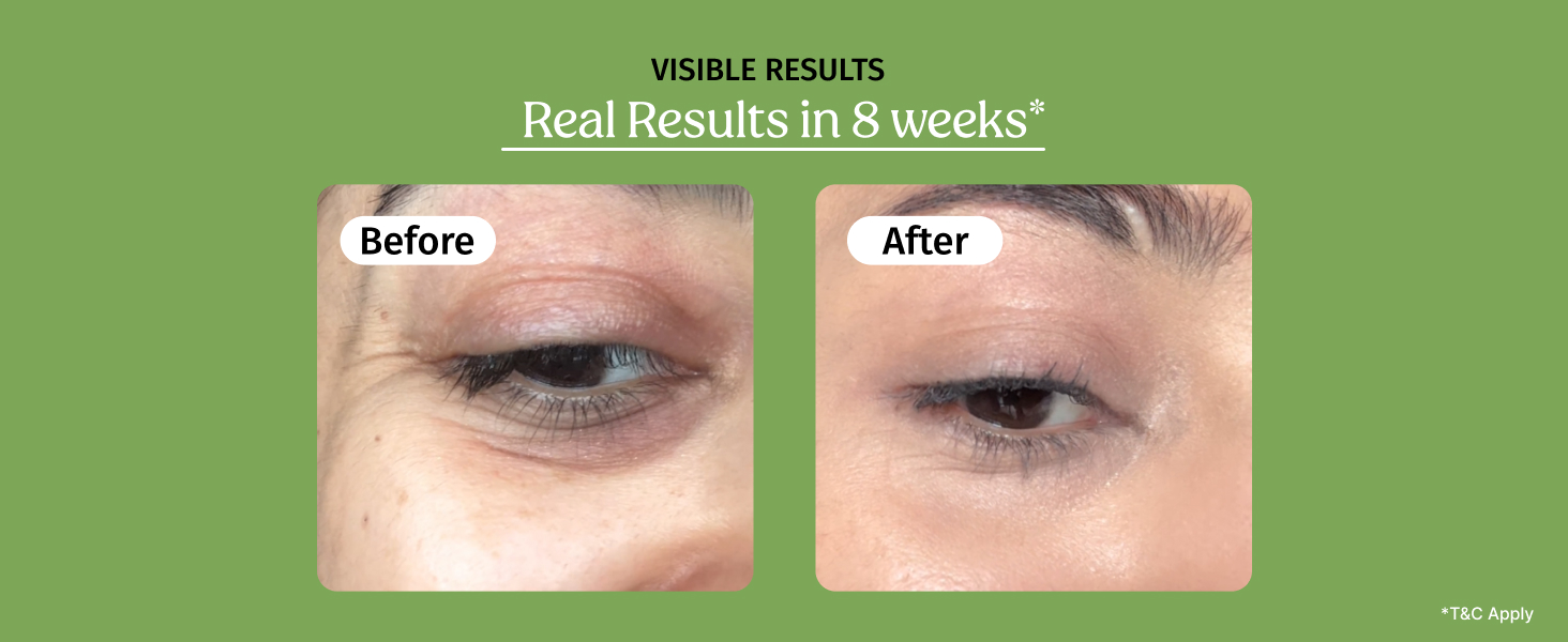 Vilvah Under Eye Cream | Reduces Dark Circles, Puffiness & Eye Bags | Hydrates, Smoothens Fine Lines & Firms Skin | Lightweight Eye Care for Tired Eyes | 20ml