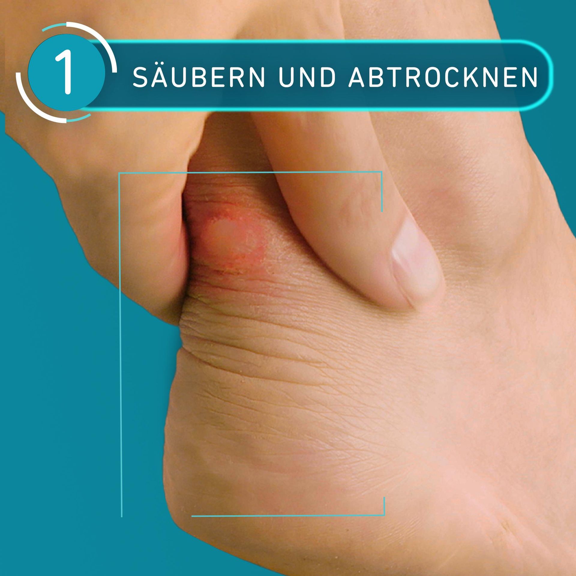 Compeed Blister Plasters Medium - 12 x Transparent Hydrocolloid Plasters