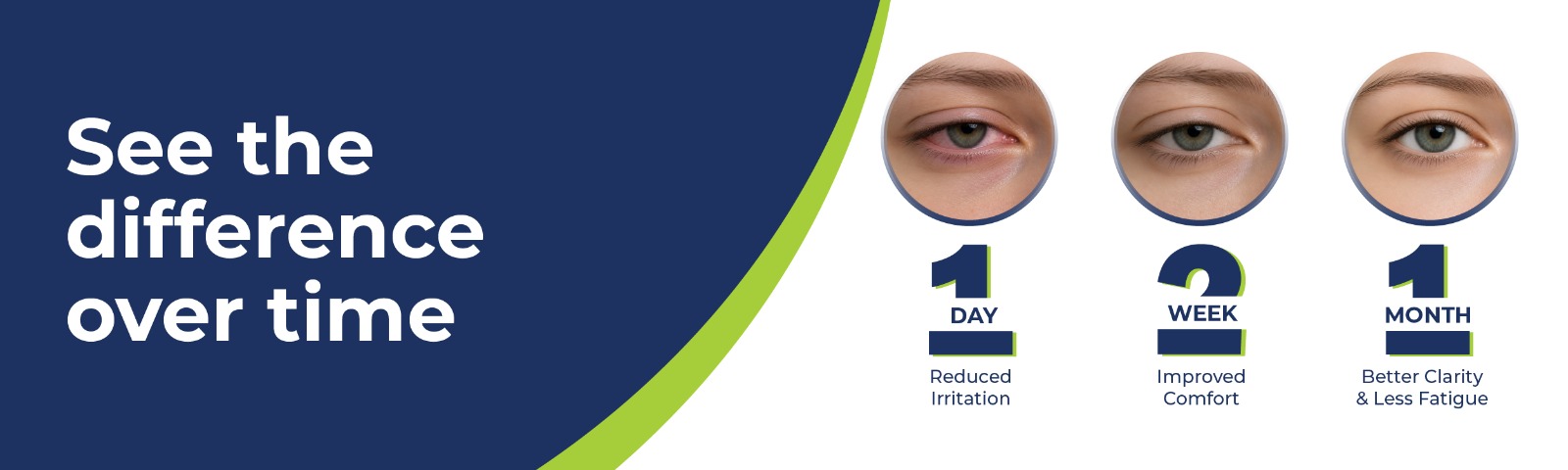 Bilberry Extract 500mg for Eye Health & Vision Support | Rich in Natural Antioxidants | Supports Healthy Eyes, Retinal Wellness & Daily Screen Exposure | 60 Veg Capsules