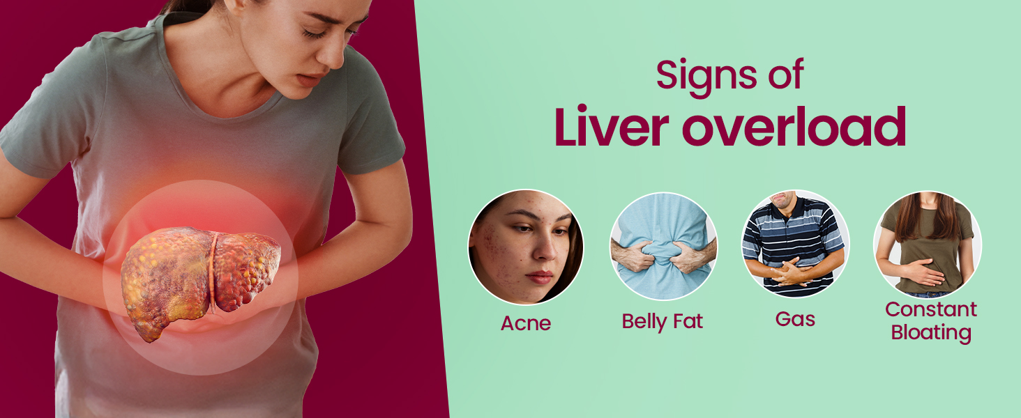 Fast&Up Liver Detox |Cleanse & Protect Liver| Milk Thistle Extract | N-Acetylcysteine (NAC) | Eliminates Toxins | Liver Recovery | Improved Liver Health (40 Effervescent Tablets, Mixed Berry Flavor)