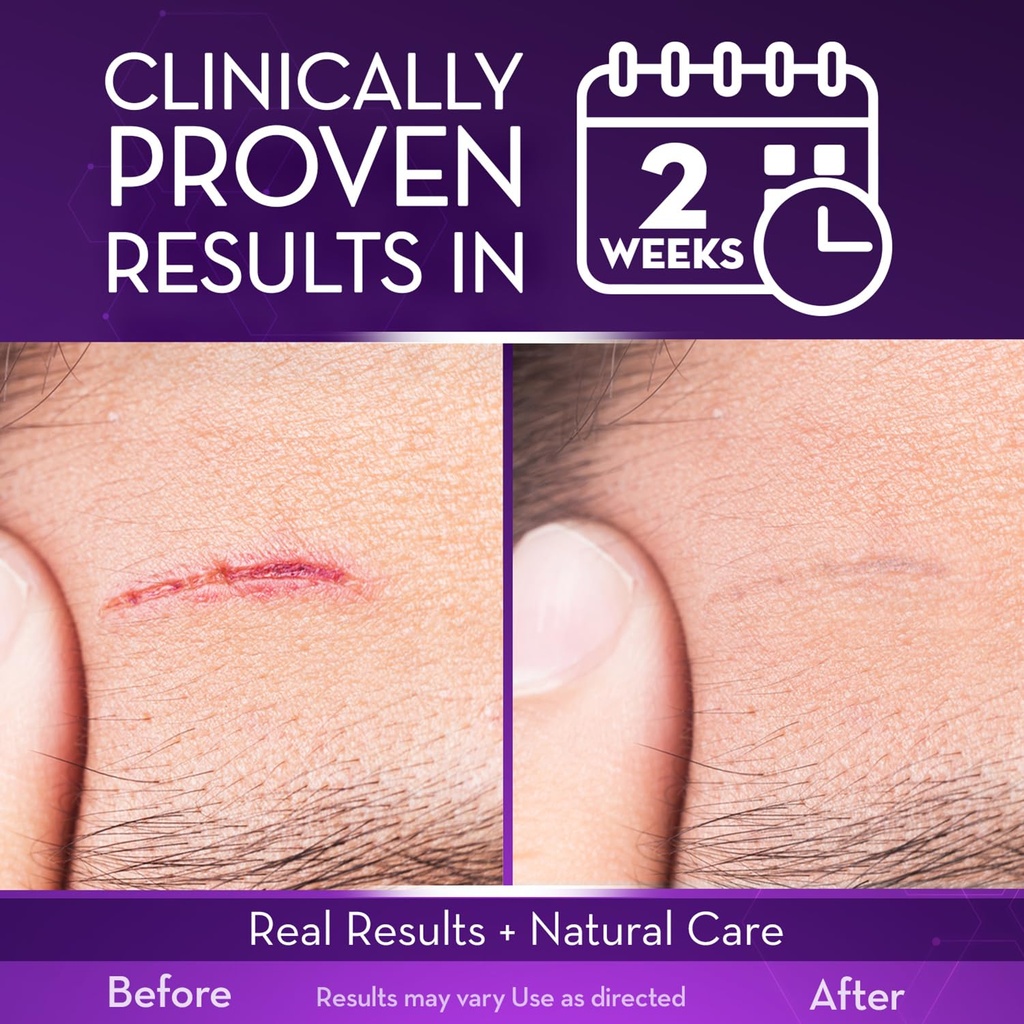 cicatricure-advanced-scar-gel-for-face-b-3.jpg