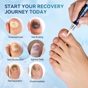 nail-fungus-treatment-pen-5-count-25-und-4.jpg