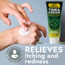 tinea-versicolor-treatment-antifungal-cr-6.jpg