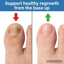 nail-care-solution-for-discolored-brittl-2.jpg