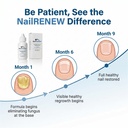nail-care-solution-for-discolored-brittl-3.jpg