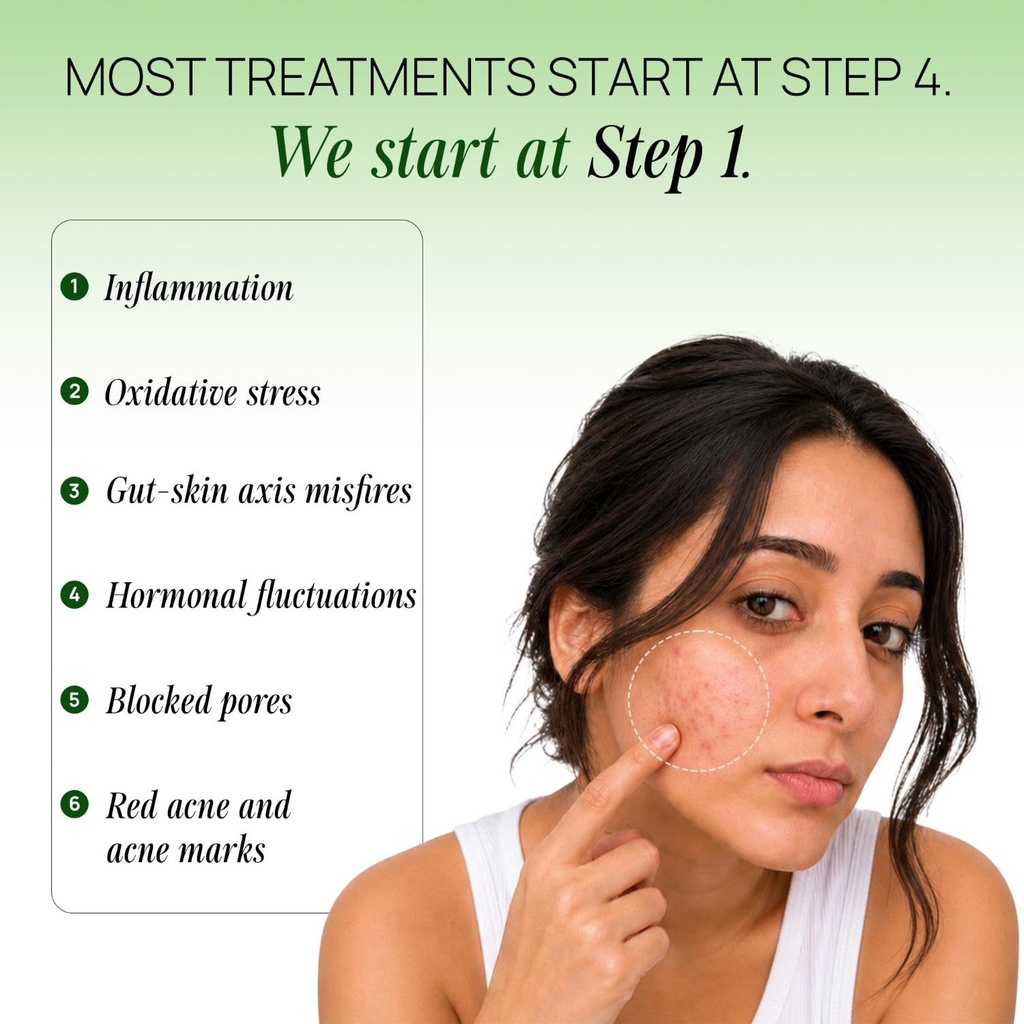 oziva-acne-care-milk-thistle-acne-supple-71vyo5MAF5L.jpg