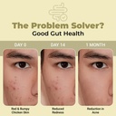 cureveda-skingut-pre-probiotic-powder-fo-619aEeGUL3L.jpg