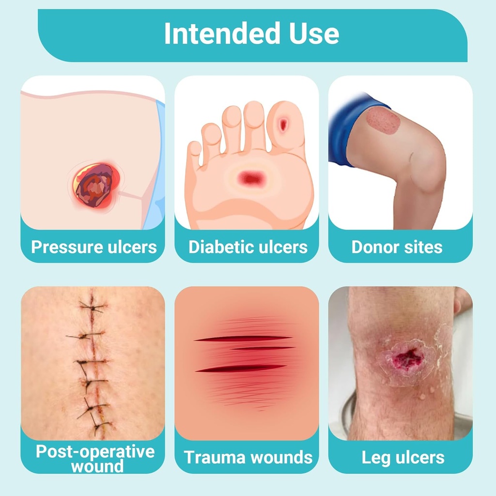 conkote-silver-alginate-wound-dressing-p-6.jpg