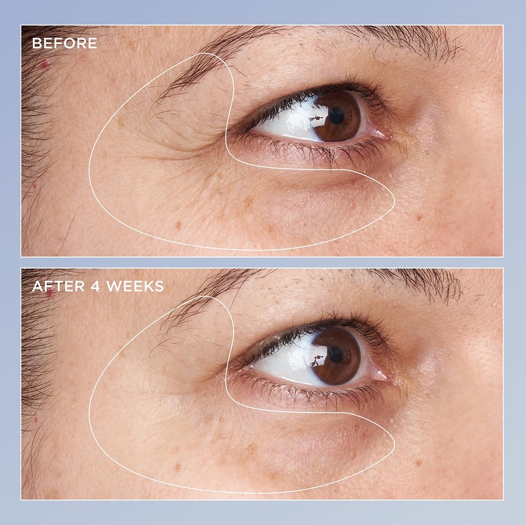 perricone-md-high-potency-triple-retinol-4.jpg
