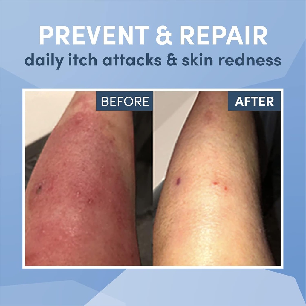 ad-rescuewear-ultra-soft-non-itch-eczema-5.jpg