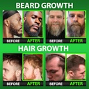 beard-growth-kit-w-620000mcg-14-in-1-bio-4.jpg
