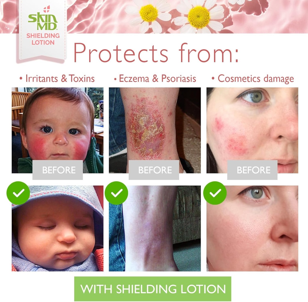 skin-md-shielding-lotion---hydrating-bod-5.jpg