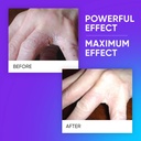 ultra-patented-anti-itch-cream-with-dhea-5.jpg