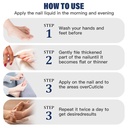 toenail-fungus-treatmentfoot-fungus-trea-3.jpg