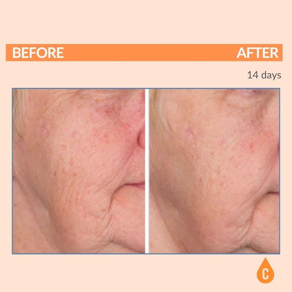serious-skincare---vitamin-c-ester-pads--4.jpg