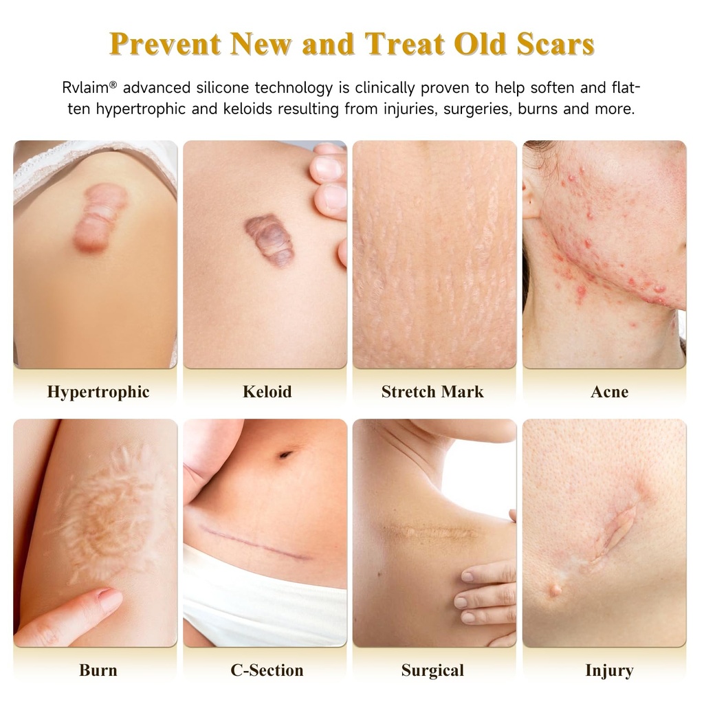 scar-cream-silicone-scar-gel-scar-cream--2.jpg
