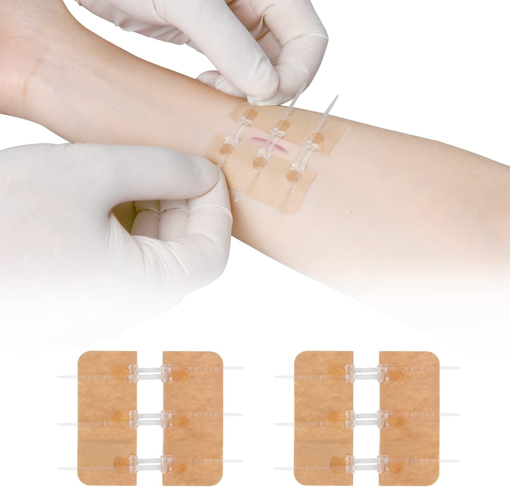 Zip Stitch Laceration Remont Ilma õmblusteta Butterfly Bandaids Quick Clot - Hädaabi Haava Sulgemine Seade 2 Pieces(PU)