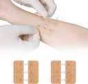 Zip Stitch Laceration Remont Ilma õmblusteta Butterfly Bandaids Quick Clot - Hädaabi Haava Sulgemine Seade 2 Pieces(PU)