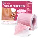 Silicone Scar Sheets, Silicone Scar Tape kirurgiliste armide jaoks, C-Section,Tummy Tuck,Keloid Bump Removal, Face Lipe kortsude jaoks üleöö (1,6 "X 59" Roll-1,5M-Pigment Reduction-Pink)