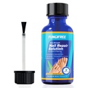 Varbaküünte seente ravi Täiendav tugevus - küünte seente ravi varbaküünte korral - varbaküünte seente ravi ekstra tugevus - küünte seente ravi (30 ml)