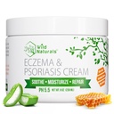 Looduslikud ekseem ja psoriaasi kreem kuivale, sügelevale nahale - ekseemi leevendamine täiskasvanutele ja lastele - psoriaasi kreem Manuka meega niisutav mesi Lotion kätele ja näole