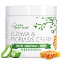 Looduslikud ekseem ja psoriaasi kreem kuivale, sügelevale nahale - ekseemi leevendamine täiskasvanutele ja lastele - niisutav psoriaaskreem Manuka meega