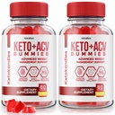 NutraRize (2 KetoKandies Keto+ACV) Kummid kaalulangus, maksimaalne tugevus täiendada, Keto Kandies Arvustused (120 Gummies)